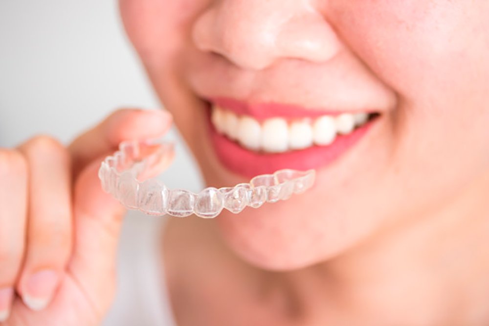 Invisalign alineadores invisibles